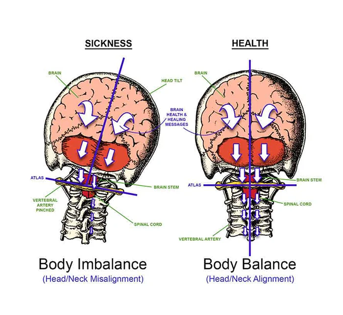 Chiropractic Anchorage AK UCC Correction